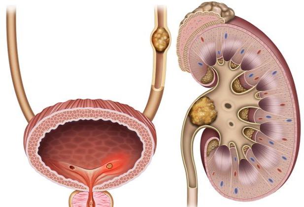 kidney health tips in Urdu