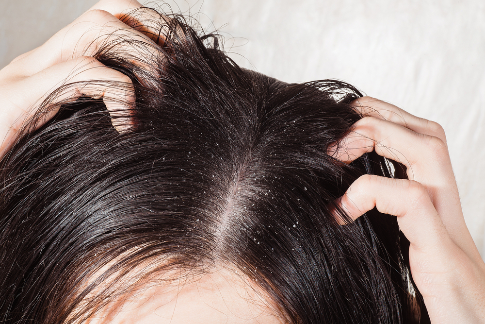 How can I fix my dry scalp?