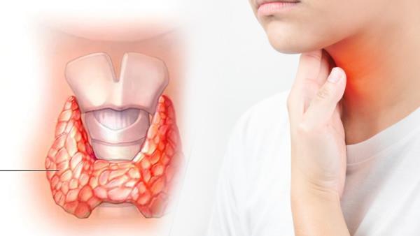 How do you know if you have a thyroid problem