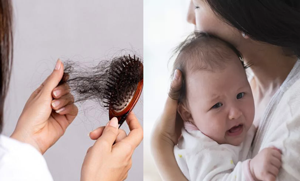  کیا آپ کے بھی بال بے تحاشا گر رہے ہیں ؟ دودھ پلانے کے دوران بالوں کے گرنے کی وجوہات اورعلاج