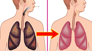 How To Clean Your Lungs From Nicotine