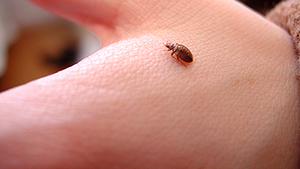 How to Get Rid of Bed Bug Bites - 5 Simple Tips