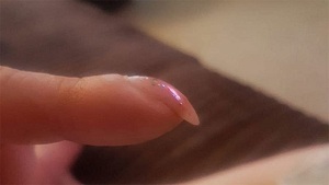 Signs Of Disease In The Nails