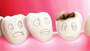 Tooth Decay Treatment with Eggshells