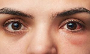 آنکھیں قدرت کی طرف سے ہمارے لئے ایک انمول تحفہ ہیں لیکن کیا آپ جانتے ہیں کہ ہم ایسی کونسی غلطیاں کرتے ہیں جس کی وجہ سے ہمارے آنکھیں بے رونق ہو جاتی ہیں، جانیں آنکھوں کی حفاظت کے چند طریقے