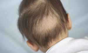 اگر آپ کے بچے کے سر پر بال پیدائشی طور پر کم ہیں ۔۔ تو یہ ٹپ آزما کر دیکھیں آپ بھی حیران رہ جائیں گی