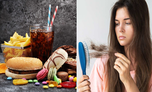 بال گرنے کی وجہ آپ کے کھانے پینے میں شامل یہ غذائیں بھی ہیں۔۔ جانئیے کون سی غذا بالوں کے لئے کتنی نقصان دہ ہے؟