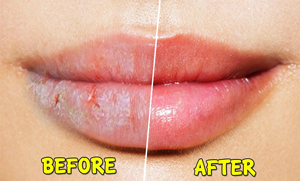 سردیوں میں ہونٹوں کو خُشکی اور پھٹنے سے بچانے کی 5 آسان گھریلو ٹپس