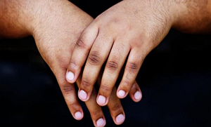 ناخنوں کے گِرد کی کالی جلد ہاتھوں کی خوبصورتی کو متاثر کرتی ہے ۔۔ ؟ جانیئے اسے صاف اور ہلکا کرنے کے چند آزمودہ گھریلو طریقے
