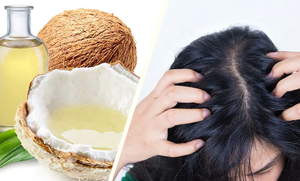 ناریل کے تیل میں نمک کو مکس کرکے بالوں میں لگانے سے کیا ہوتا ہے؟ جانیئے بالوں کے 4 مسائل کا بہترین حل