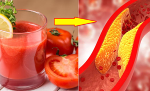 ٹماٹر کا جوس کولیسٹرول کم کرتا ہے۔۔ جانیں اس سے متعلق ماہرین کا بتایا گیا ایسا طریقہ جو چند ماہ میں آپ کی اضافی چربی کو ختم کرسکتا ہے