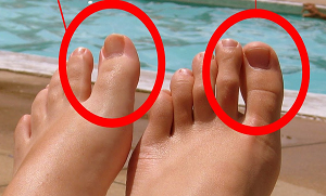 کیا آپ جانتے ہیں کہ اگر پاؤں کے انگوٹھے اور انگلی کے درمیان فاصلہ ہو تو اس کا کیا مطلب ہوتا ہے؟ دلچسپ معلومات جو آپ کے لیے جاننا ضروری ہے