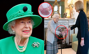 کیا نشان سے معلوم ہوگیا تھا کہ ملکہ کی موت ہونے والی ہے؟ ملکہ برطانیہ کے ہاتھ پر نیلے رنگ کا نشان کیوں آگیا تھا؟