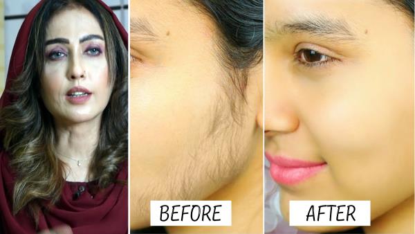 Home Remedies for Unwanted Facial Hair