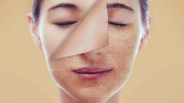 Khushk Jild Ka Asan Ilaj