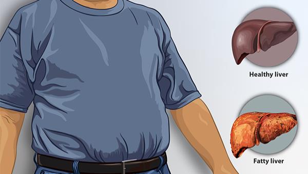 Jigar Ki Garmi Khatam Karne ka Tarika