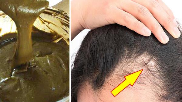 Regrow Your Hair Naturally