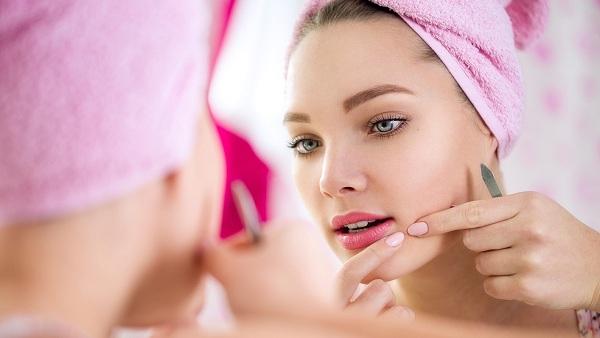 Home Remedies for Acne & Pimples - Keel Mahasay ka ilaj