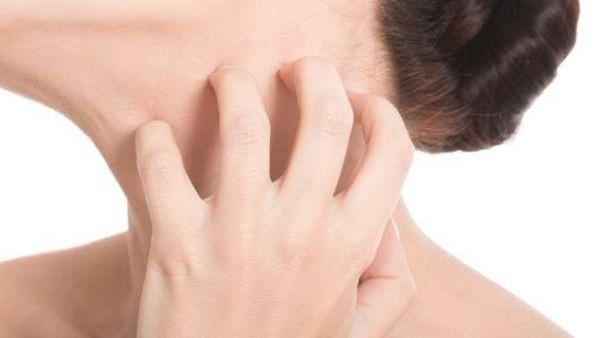 Tips to Reduce Face Itching!