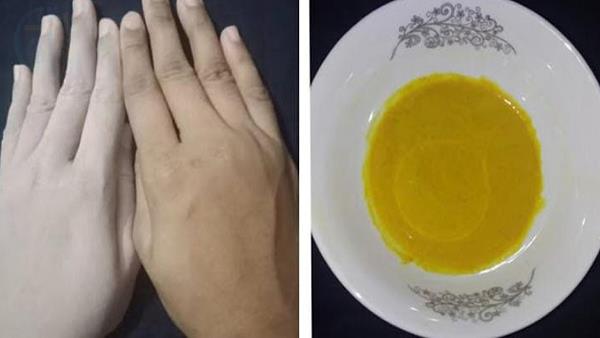 Hathon Ki Jild Ko Saaf Karne Ka Tarika