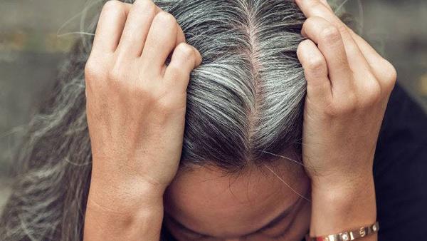 Sufaid Bal Kale Karne ka Tarika