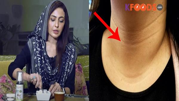 Gardan Ki Kali Lakeerain Khatam Karne Ka Tarika