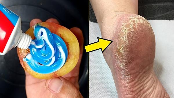 Tooth Paste Se Heels Saaf Karne Ka Tarika