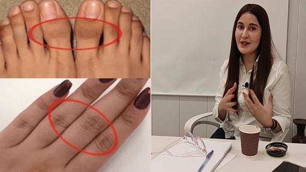 Hath Paon Ki Rangat Saaf Karne Ka Tarika