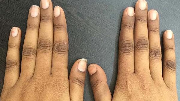 Ungliyon Ke Gird Siyah Pan Door Karne Ka Tarika