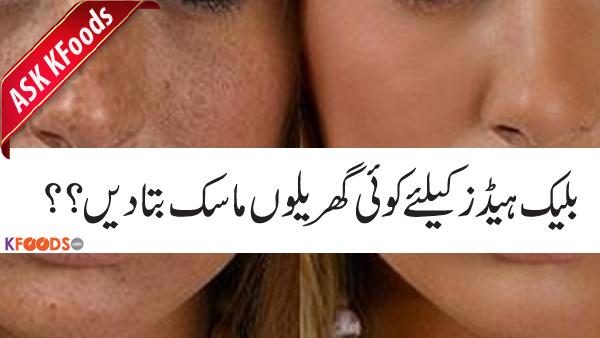 Black heads k bohat se treatment mene use kiye par bohat expensive or dar rehta hai k koi side effects na hojaye is liye mujhe koi gharelu mask etc bata dein black heads k liye thanks