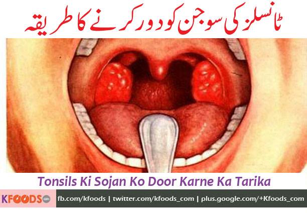 Salam mam and Jazak Allah for your valuable videos and tips about some common issues, here i come to know about the home treatment for swollen tonsils, please share your expertise for this issue as well, thanks in advance