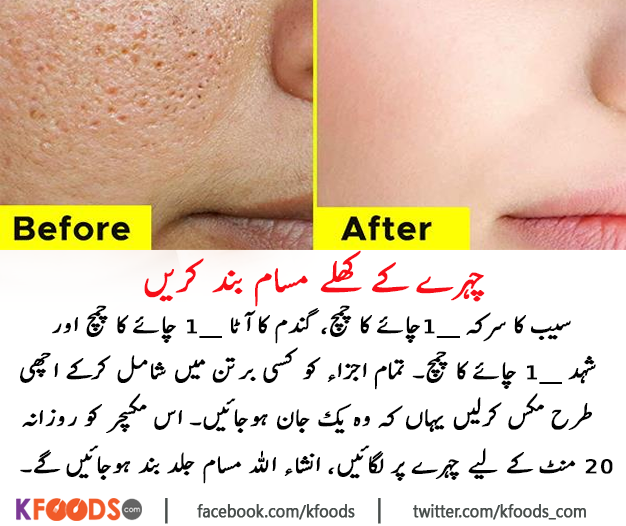 Remove Open Pores