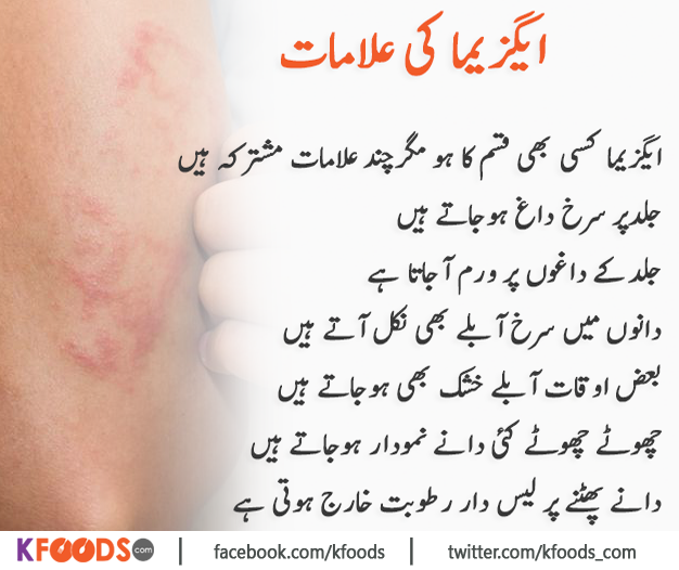 eczema meaning in urdu száraz bőr az arcon vörös foltok